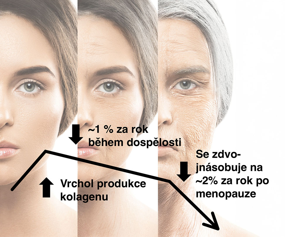 Klinické Studie 1 Clinical Studies Verisol Collagen CZ